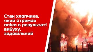 Стан хлопчика, який отримав опіки в результаті вибуху у Станиці Луганській, задовільний