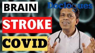 Brain Stroke in Covid