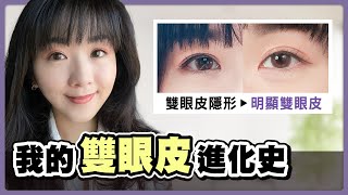 「雙眼皮手術」前後照片大公開！訂書針雙眼皮還是縫雙眼皮效果更好？｜彤顏診所