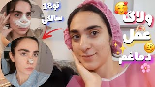 ولاگ عمل دماغم👃😍باحال ترین تجربه۱۸سالگی✌