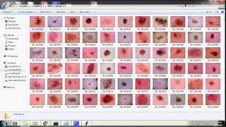 Skin lesion classification using hybrid deep neural networks