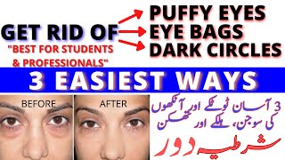 One Day Soothing Eyes Challenge | Home Remedy Eye Bags And Puffy Eyes | Healthcare Remedy