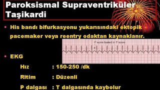 PAROKSİSMAL SUPRAVENTRİKÜLER TAŞİKARDİ(PSVT)