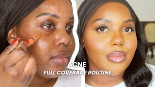 Get Rid Of Acne Scars Fast! (Full Coverage Acne Routine For Acne / Hyperpigmentation)