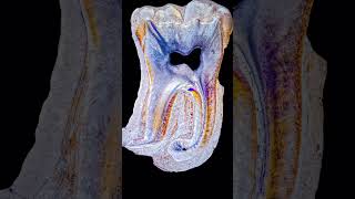 Tooth slices in cross-polarized light #tooth #toothslices #crosspolarizedlight