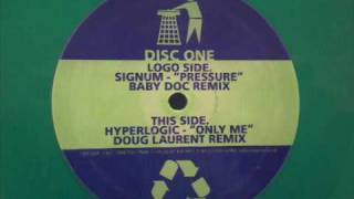 hyperlogic only me doug laurent remix