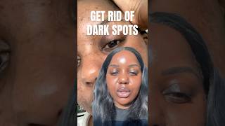 GOODBYE DARK SPOTS #skincare #acneproneskincareroutine #hyperpigmentation #fadedarkspots