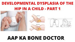 DEVELOPMENTAL DYSPLASIA OF THE HIP IN A CHILD - PART 1 - EPISODE 22