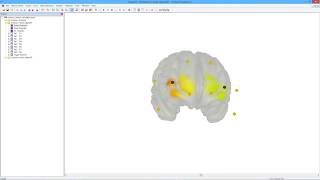 3D Digitization and Co-Registration to the MNI brain template using Polhemus digitizer and OxySoft