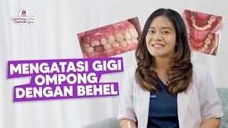 GIGI OMPONG JADI RAPET KARENA BEHEL! INI DIA PENJELASAN DARI SPESIALIS