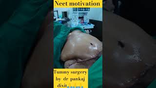 tummy surgery by Dr pankaj Dixit #neet#mbbs#aiims#doctor #ytshorts #shorts