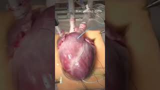 ધબકતું હ્દય | working human heart | beating human heart