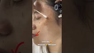 Skin Brightening Serum #india #viral #trending #skincare #youtube