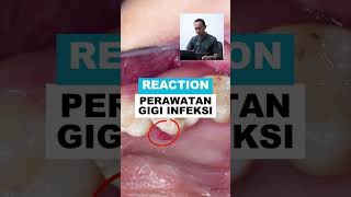 Reaction "Perawatan Gigi Infeksi" | New Look Dental Care 087770139191