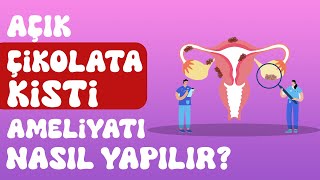 Açık Çikolata Kisti Ameliyatı Nasıl Yapılır? Açık Çikolata Kisti Ameliyatının Riskleri Nelerdir?