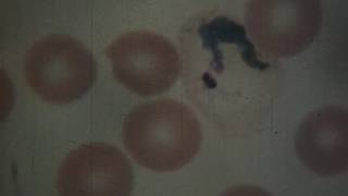 2011.243 Microscopical Diagnosis of Human Malaria