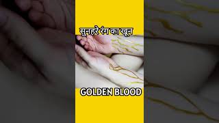 सुनहरे रंग का खून | Golden blood 😱 #shorts #facts