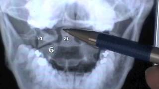 ANATOMIA 2.0: INTERPRETACION DE ESTUDIOS RADIOLOGICOS DE COLUMNA