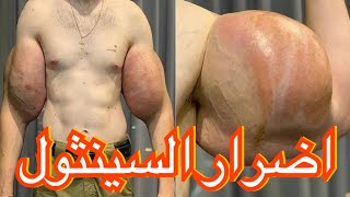 ايه هوا السينثول اضرار السينثول #gym #fitness