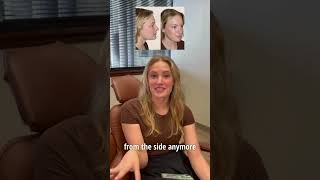 Patient Testimonials: Cosmetic Rhinoplasty