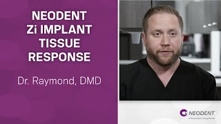 Neodent Zi Implant Tissue Response | Dr. Raymond