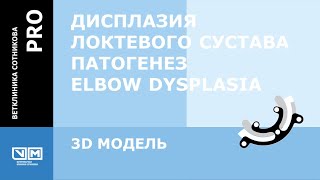 Дисплазия локтевого сустава  Патогенез  Elbow Dysplasia 3D