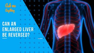 Can an Enlarged Liver be Reversed? Can Enlarged Fatty Liver be Reversed?