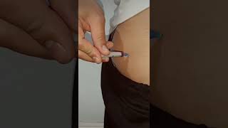 b12 injection be given in the buttocks