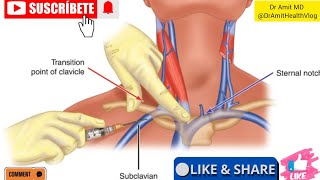 Central line Placement  ||  Subclavian .