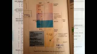 spinothalamic tract|Fcps part-1 preparation forum.. rafiullah past papers mcques