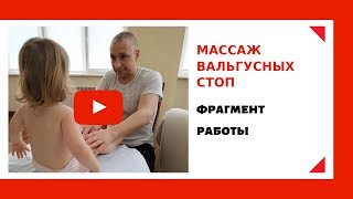 Вальгус. Фрагмент работы. Ялта. Массаж.