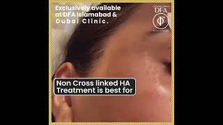 Non cross linked HA treatment- Dr Fazeela Abbasi