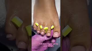 She had these on for 2 months , acrylic toes 🥰