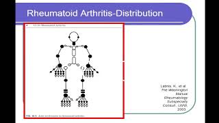 15:40  Approach to the patient with ARTHRITIS