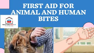 First aid for animal and human bites