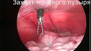 Endoscopic assisted Cystotomy Cat