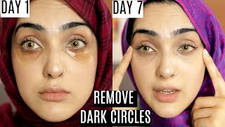 REMOVE DARK CIRLCES IN 7 DAYS (Natural Dark Circle+ Wrinkle & Fine Line DIY) ~Immy