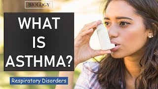 ASTHMA - RESPIRATORY DISORDERS