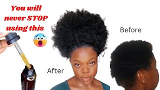 Make this EFFECTIVE treatment if you experience slow growth #naturalhair #cloves #rosemary #diy