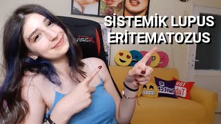 HASTALIĞIM GEÇTİ Mİ? ( Sistemik Lupus Eritematozus)