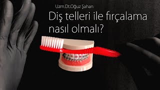 Uzm.Dr.Oğuz Şahan - Diş telleri ile nasıl diş fırçalanır? Diş telleri nasıl temizlenir?