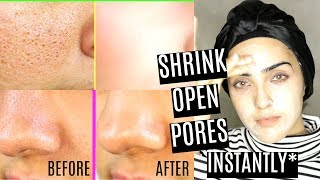 HOW TO SHRINK/CLOSE PORES FAST| PORE CLEANSING AT HOME~ Immy