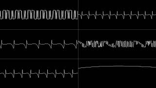 Takashi Tateishi - "L.E.D. Storm/Mad Gear (Arcade) - Million Valley (Stage 6)" [Oscilloscope View]