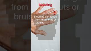 Bleeding │ Selected medical terminology │ #medicalterminology #bleeding  #short