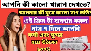 Melalite XL cream (ফর্সা হওয়ার ক্রিম) full review in bangla, uses, price, dosage