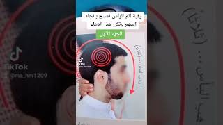 رقية إزالة ألم الرأس