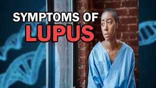 What are the Symptoms of Lupus; Effective Natural Therapies