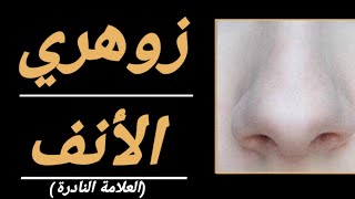 🔴 زوهري الأنف | الزوهري النادر كاشف الأسحار وفاضح للجن والعفاريت ....من هو و كيف تتعرف إليه ؟