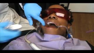 Dr. Mariam removes original material from tooth