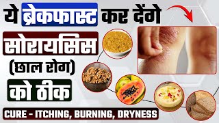 Skin rog kis vitamin ki kami se hota hai | सोरायसिस के मरीज नाश्ते में क्या खाएं ?